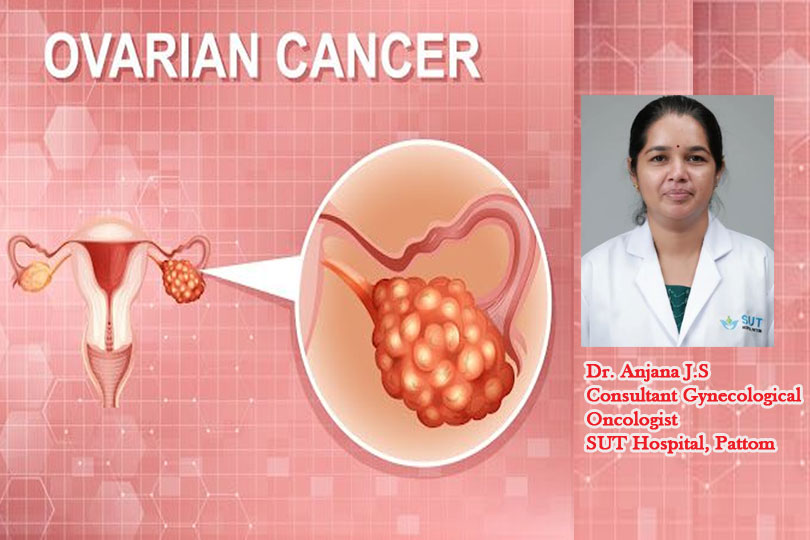 അണ്ഡാശയ അര്‍ബുദം: പ്രതിരോധവും വസ്തുതയും